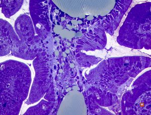 cured Whipple disease (semithin section)